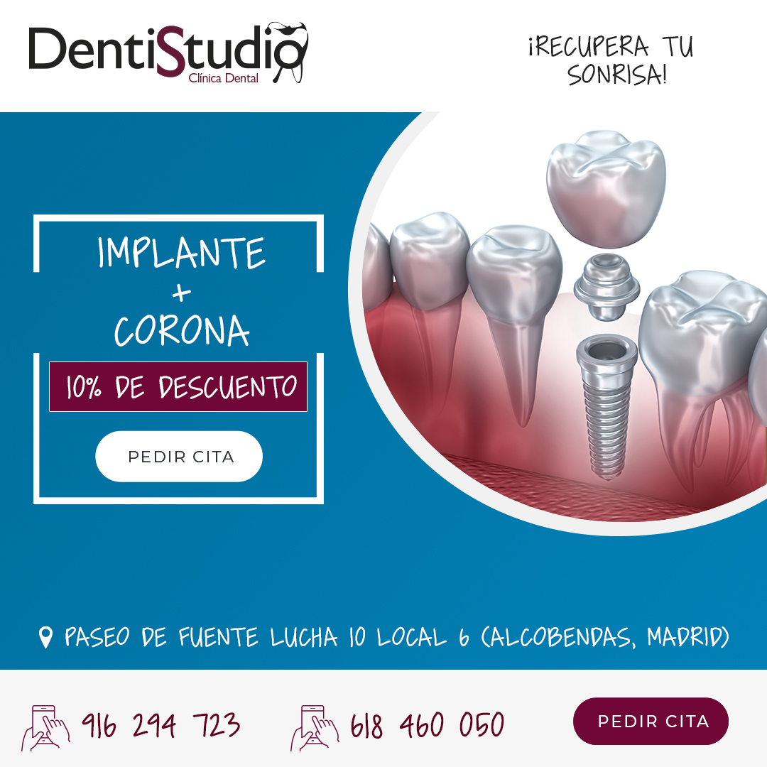 Promoción Implantes y coronas en Alcobendas