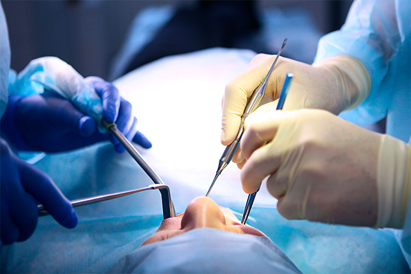 Cirugía Dental Alcobendas